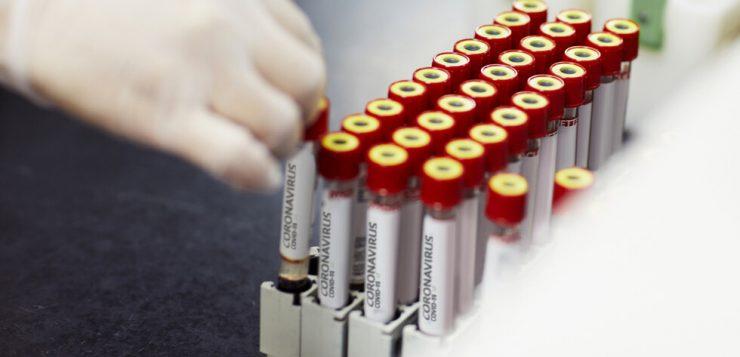 122 са излекуваните от COVID-19, общо заразени са 783