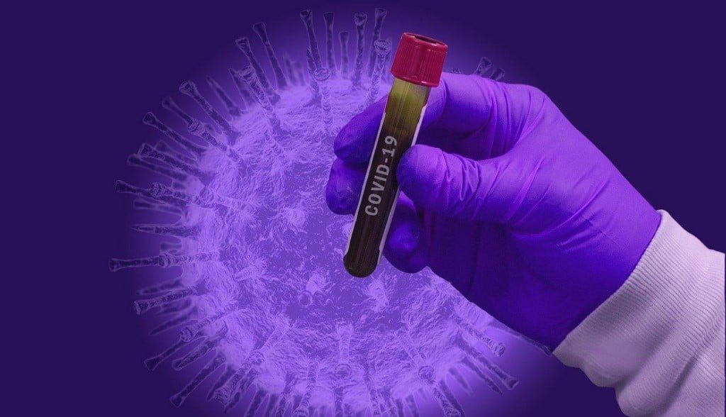 Жена с COVID-19 почина в "Пирогов", заразените са вече 549