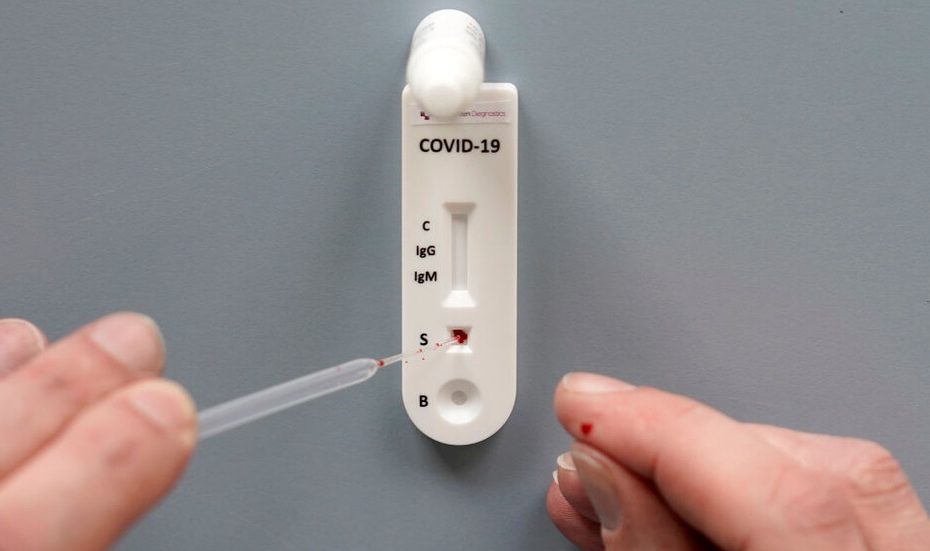 25 нови с COVID-19 в Хасковско, 3 починали